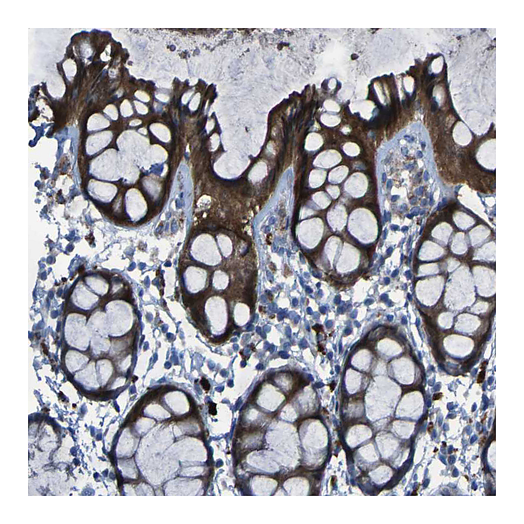 Atlas Antibodies Anti-SGK2 Antibody
