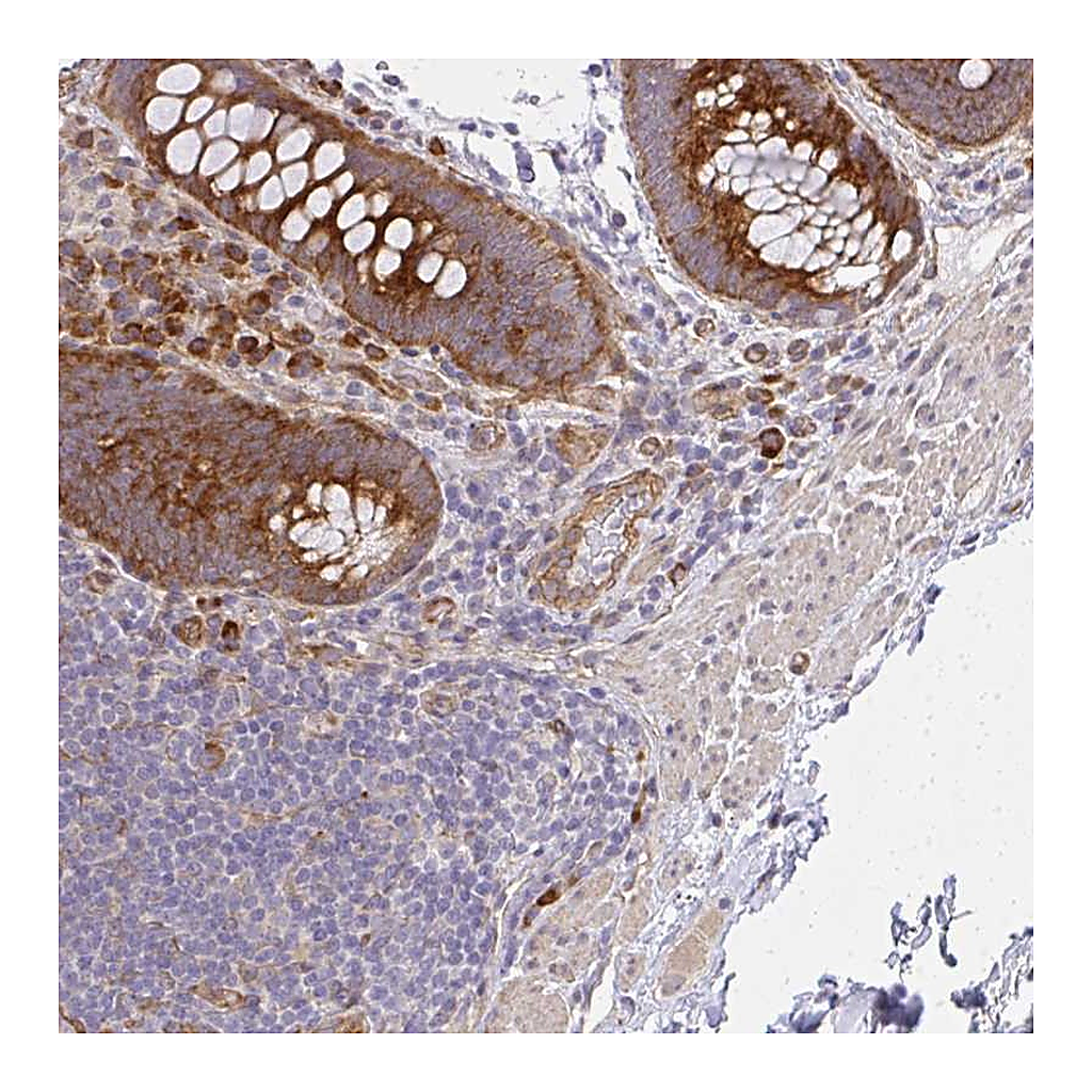 Atlas Antibodies Anti-SGK494 Antibody