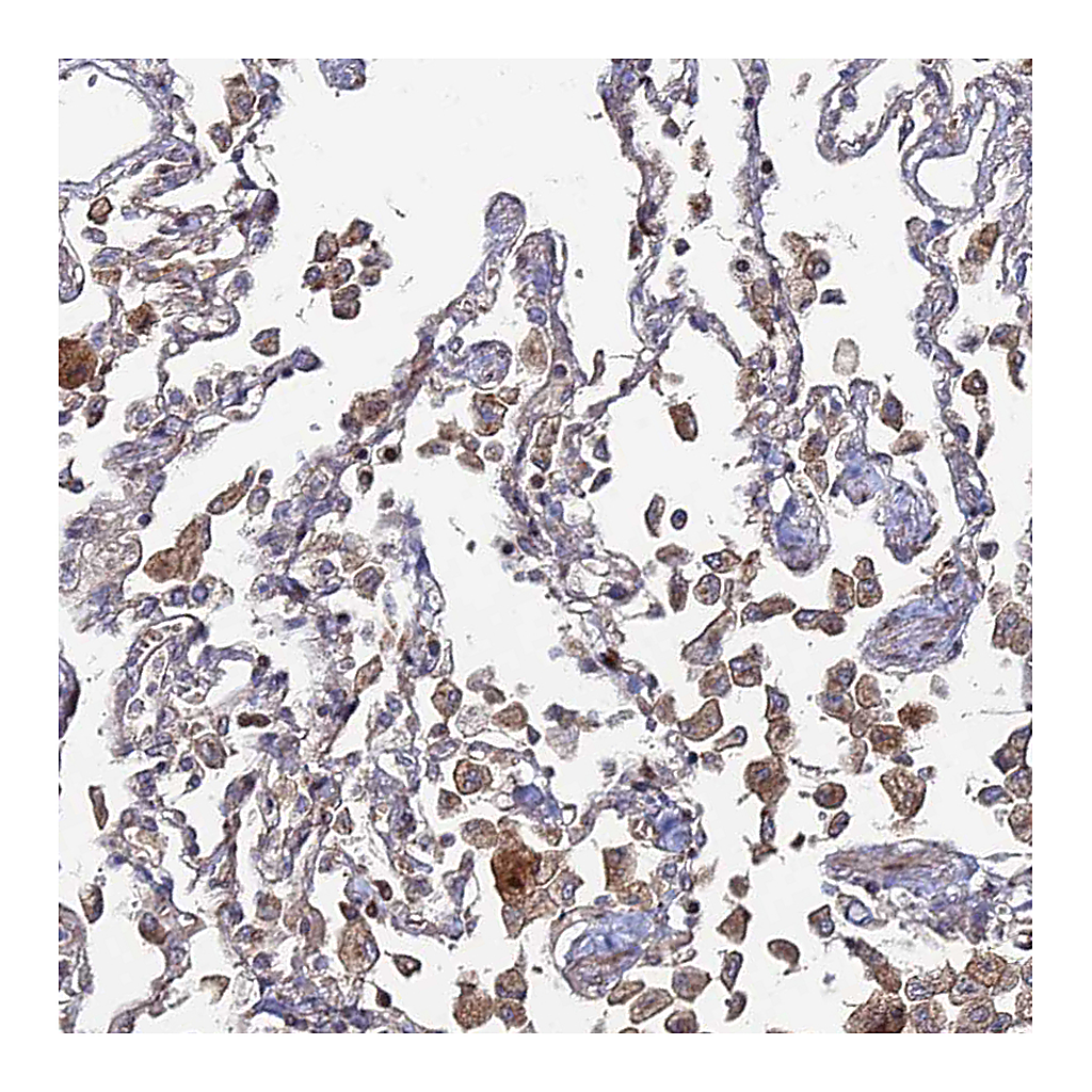 Atlas Antibodies Anti-SGMS1 Antibody