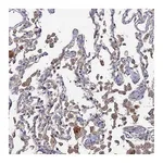 Atlas Antibodies Anti-SGMS1 Antibody