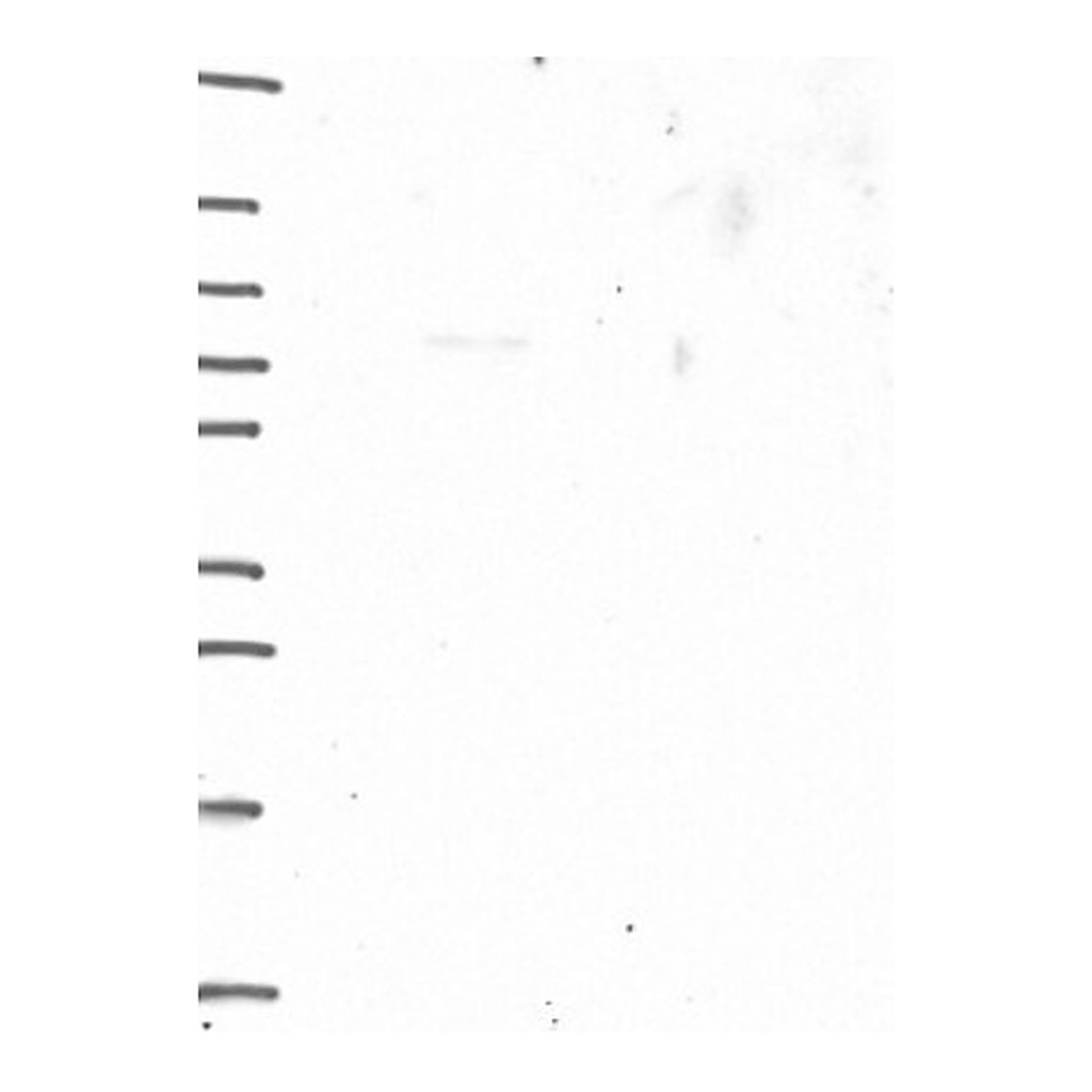 Atlas Antibodies Anti-SGO1 Antibody