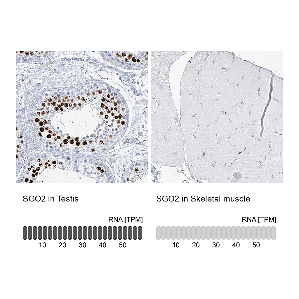 Atlas Antibodies Anti-SGO2 Antibody