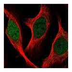 Atlas Antibodies Anti-SGO2 Antibody