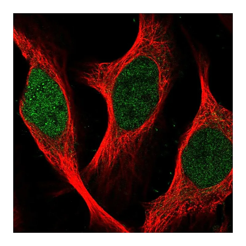 Atlas Antibodies Anti-SGO2 Antibody