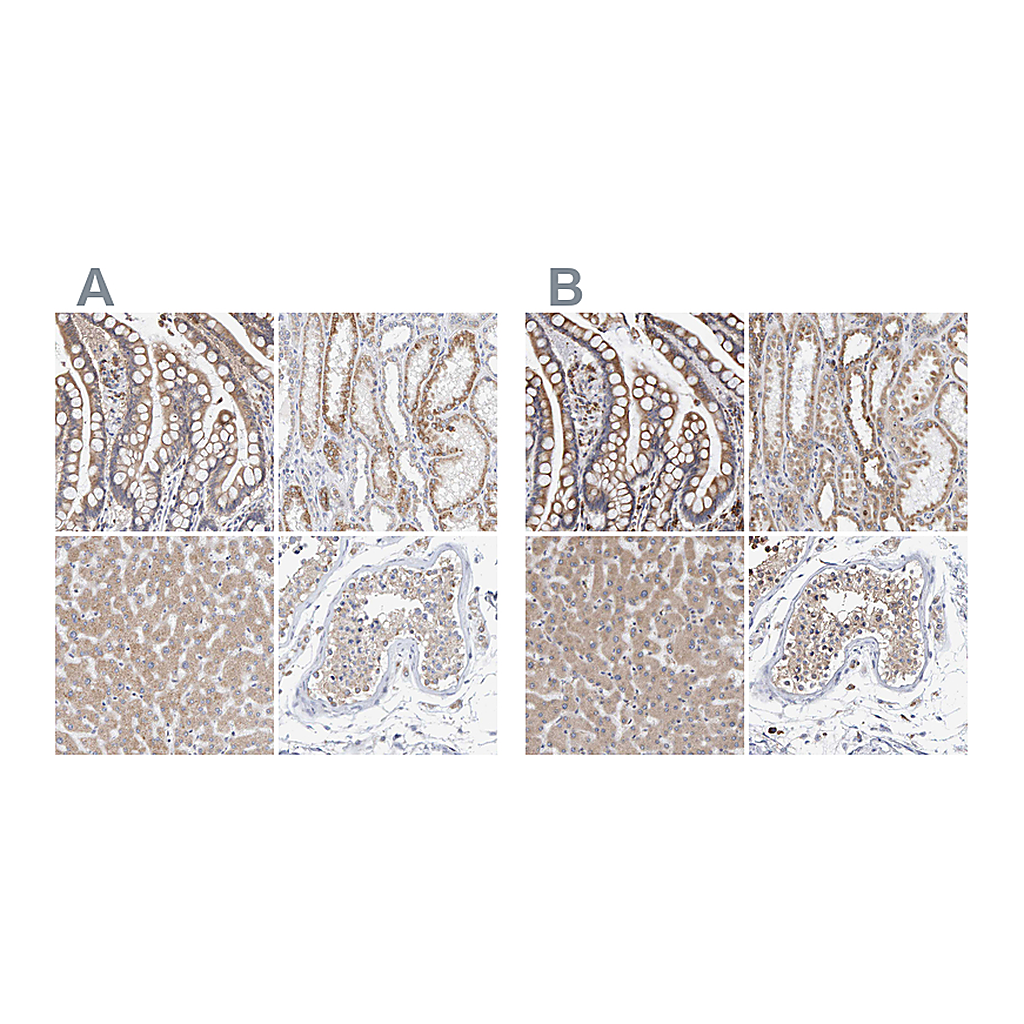 Atlas Antibodies Anti-SGPL1 Antibody