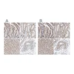 Atlas Antibodies Anti-SGPL1 Antibody
