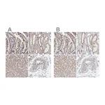 Atlas Antibodies Anti-SGPL1 Antibody