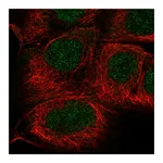 Atlas Antibodies Anti-SGPP1 Antibody