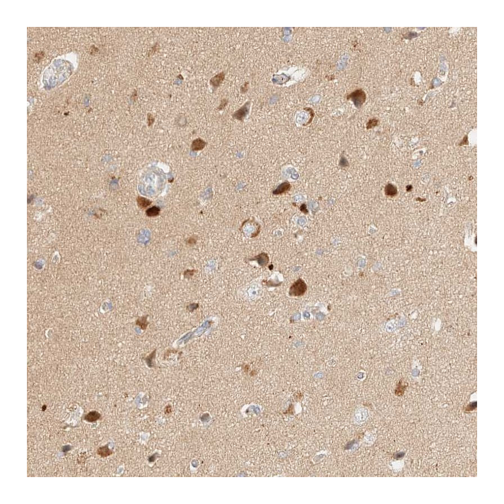 Atlas Antibodies Anti-SGSM2 Antibody