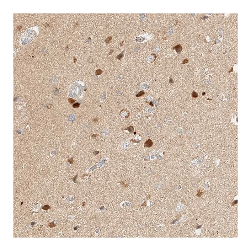 Atlas Antibodies Anti-SGSM2 Antibody