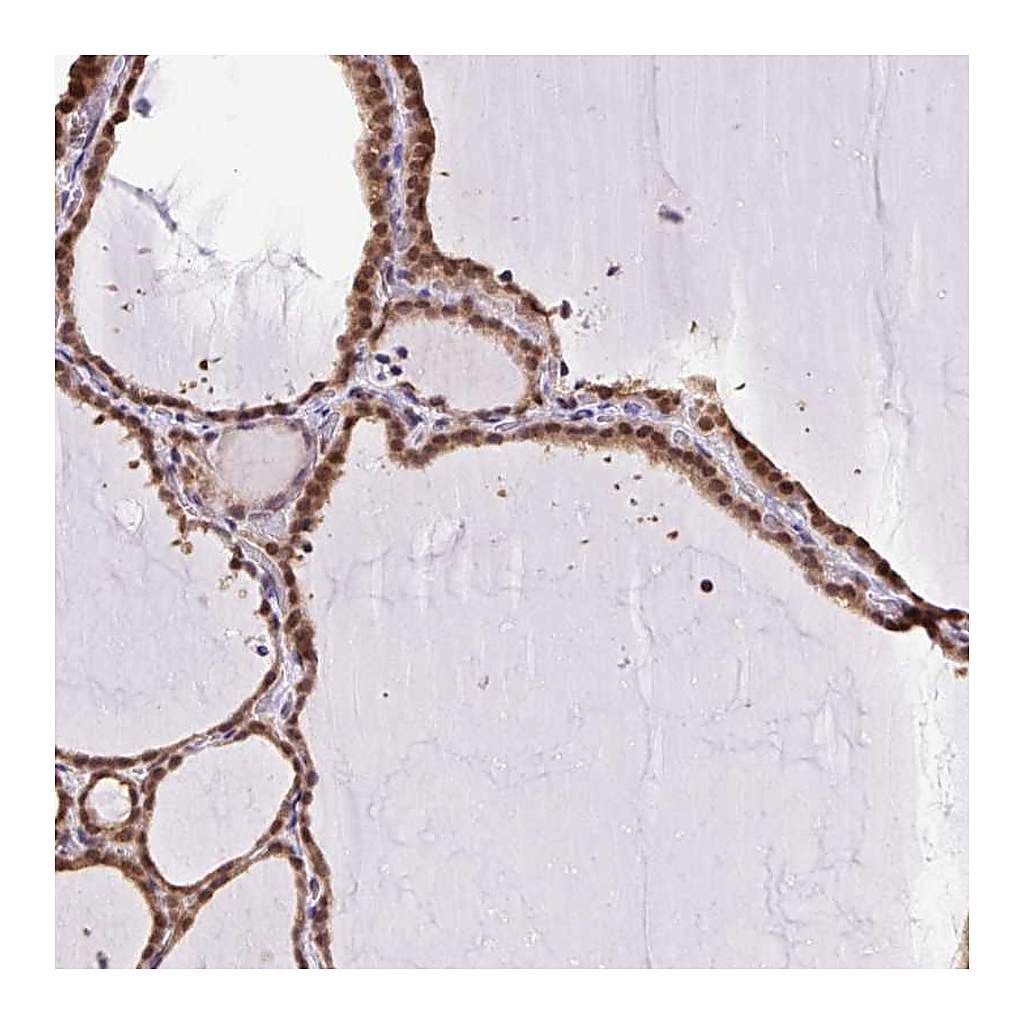 Atlas Antibodies Anti-SGTA Antibody