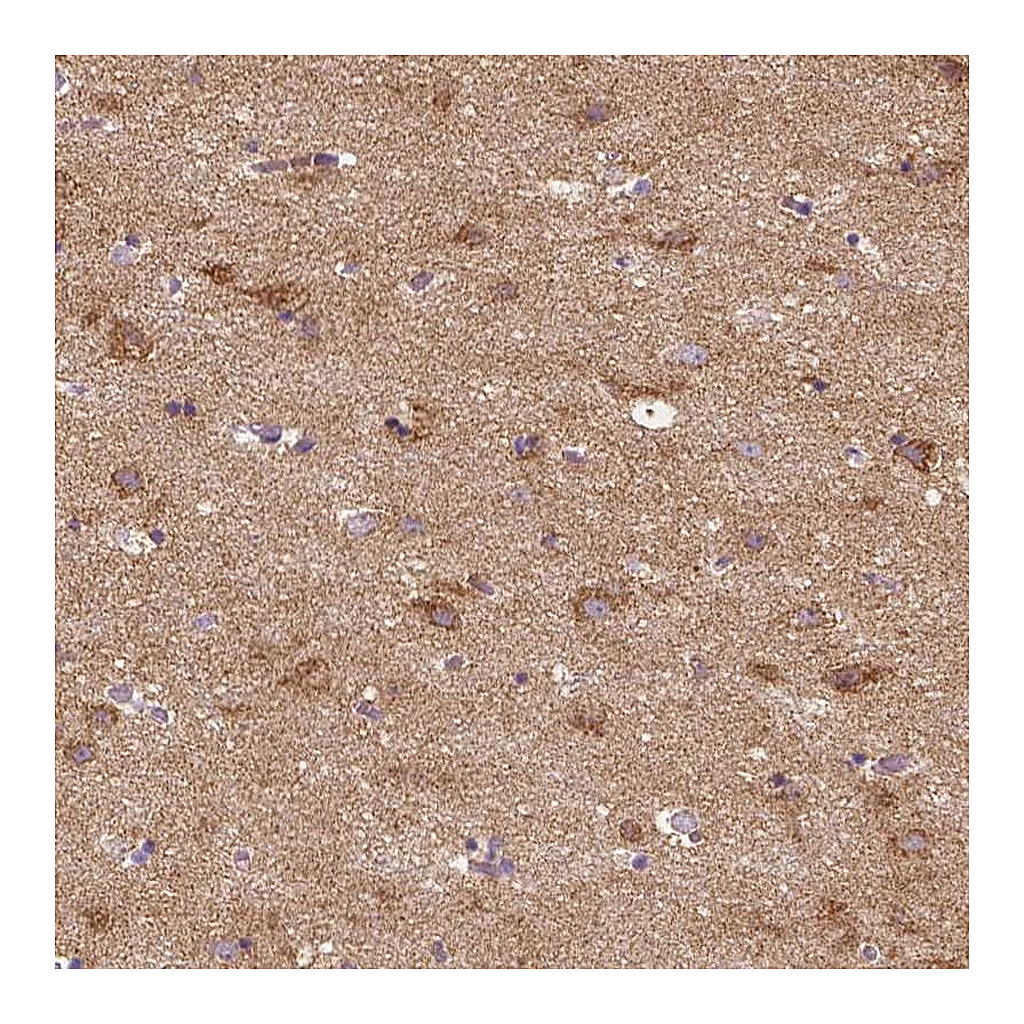 Atlas Antibodies Anti-SGTB Antibody