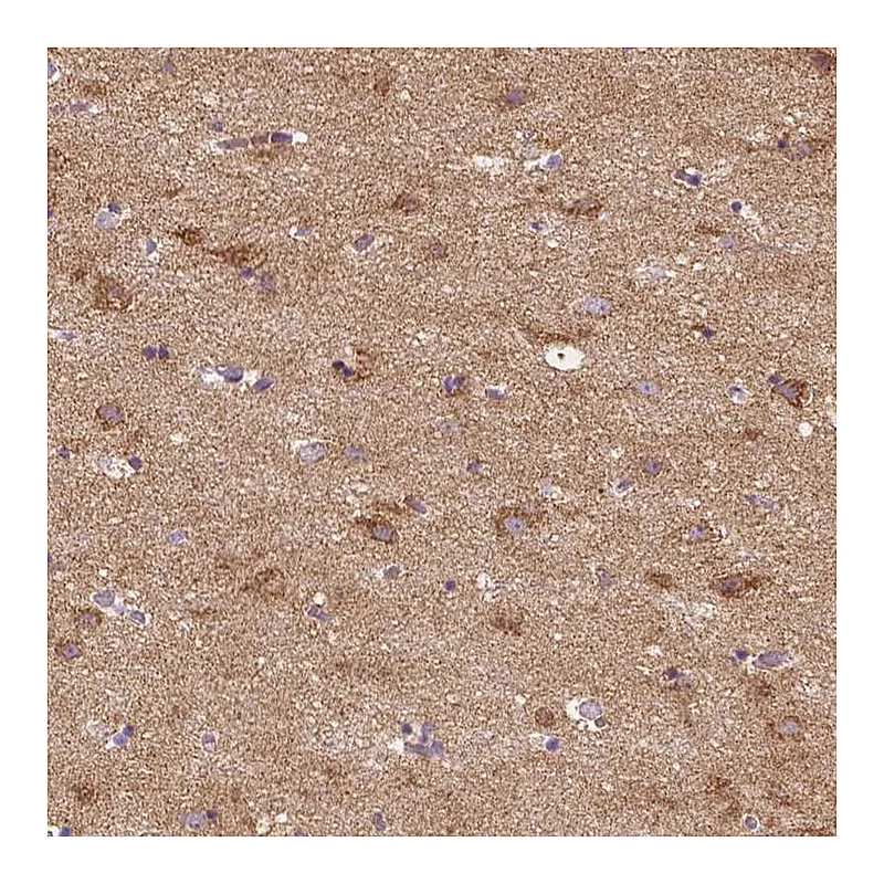 Atlas Antibodies Anti-SGTB Antibody