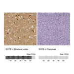 Atlas Antibodies Anti-SGTB Antibody
