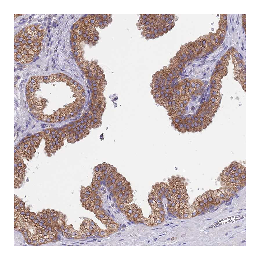 Atlas Antibodies Anti-SH2B2 Antibody