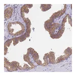 Atlas Antibodies Anti-SH2B2 Antibody