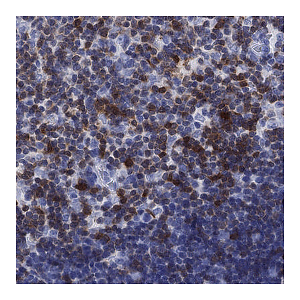 Atlas Antibodies Anti-SH2D2A Antibody