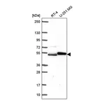 Atlas Antibodies Anti-SH2D3A Antibody