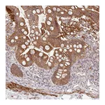 Atlas Antibodies Anti-SH2D3A Antibody