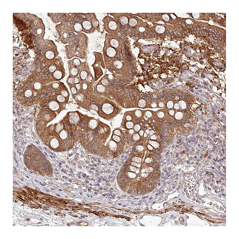 Atlas Antibodies Anti-SH2D3A Antibody