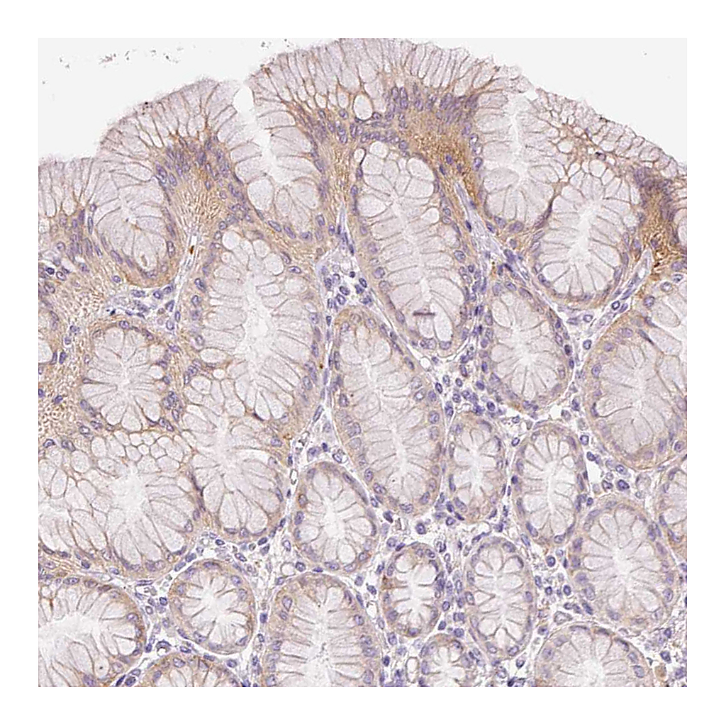 Atlas Antibodies Anti-SH2D6 Antibody