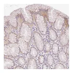 Atlas Antibodies Anti-SH2D6 Antibody