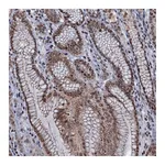 Atlas Antibodies Anti-SH2D4B Antibody