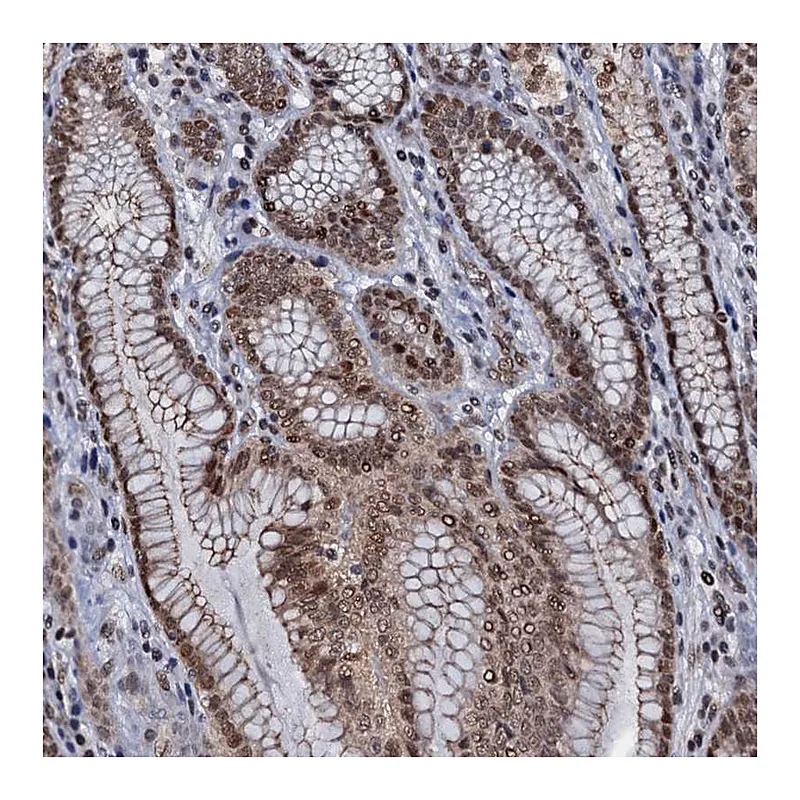 Atlas Antibodies Anti-SH2D4B Antibody