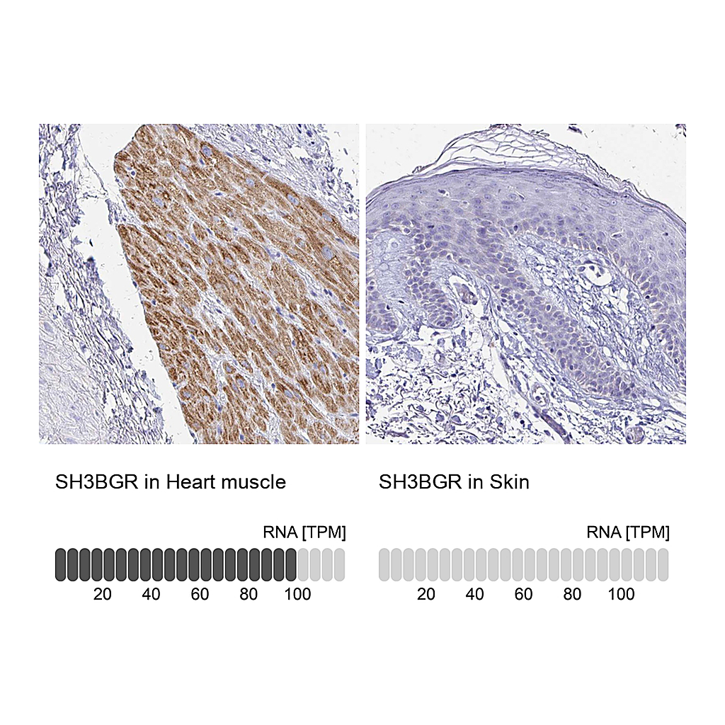 Atlas Antibodies Anti-SH3BGR Antibody