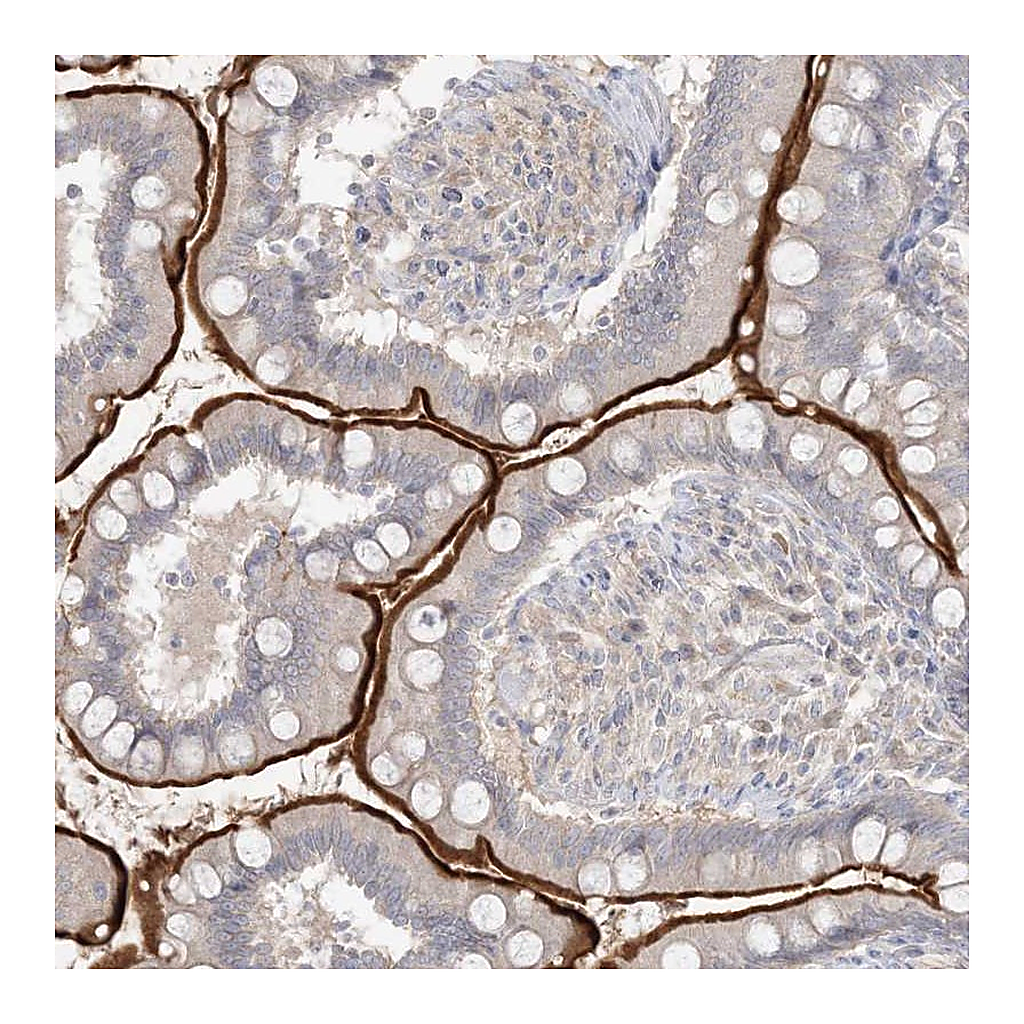 Atlas Antibodies Anti-SH3BP4 Antibody