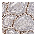 Atlas Antibodies Anti-SH3BP4 Antibody
