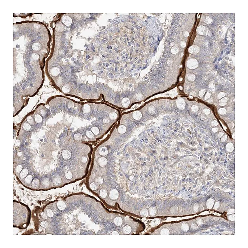 Atlas Antibodies Anti-SH3BP4 Antibody