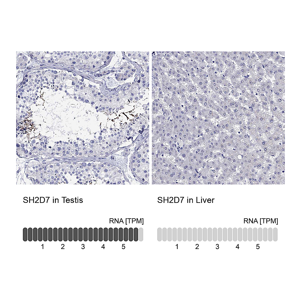 Atlas Antibodies Anti-SH2D7 Antibody