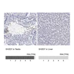 Atlas Antibodies Anti-SH2D7 Antibody