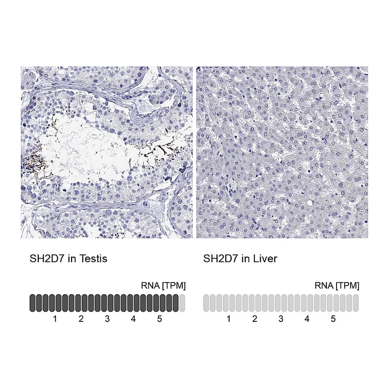 Atlas Antibodies Anti-SH2D7 Antibody