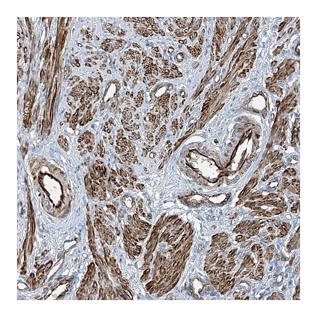 Atlas Antibodies Anti-SH3BGRL3 Antibody