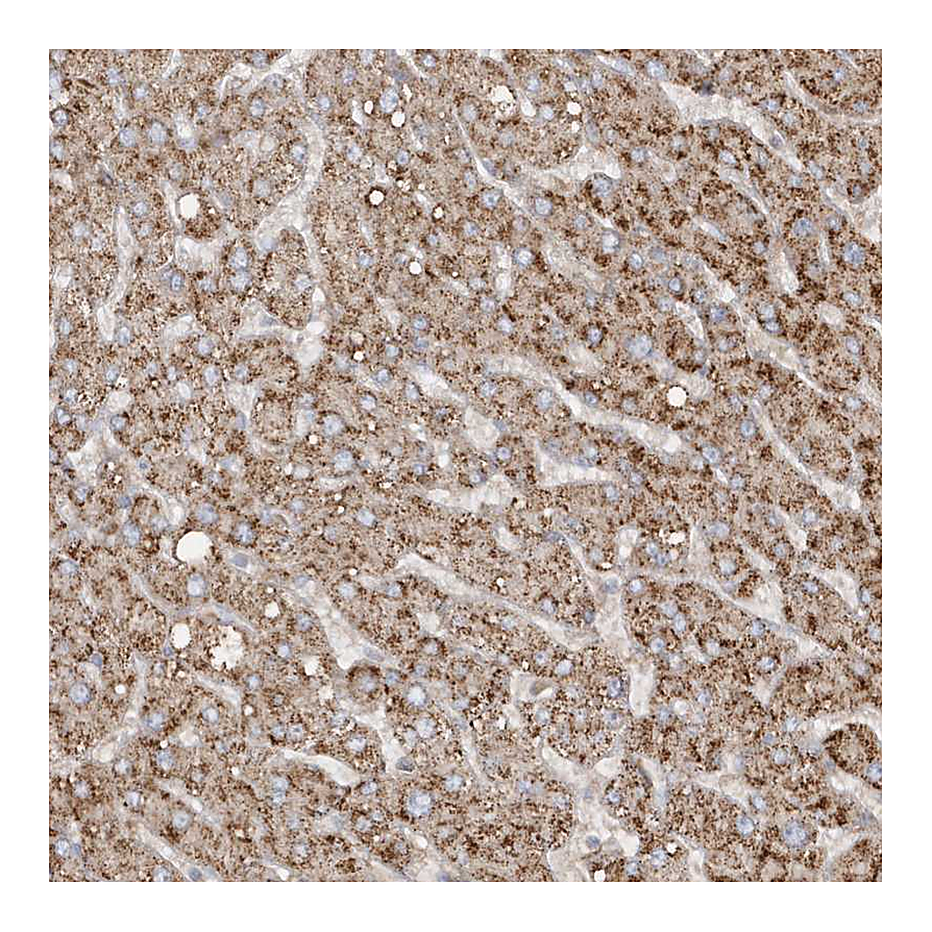Atlas Antibodies Anti-SH3BP2 Antibody