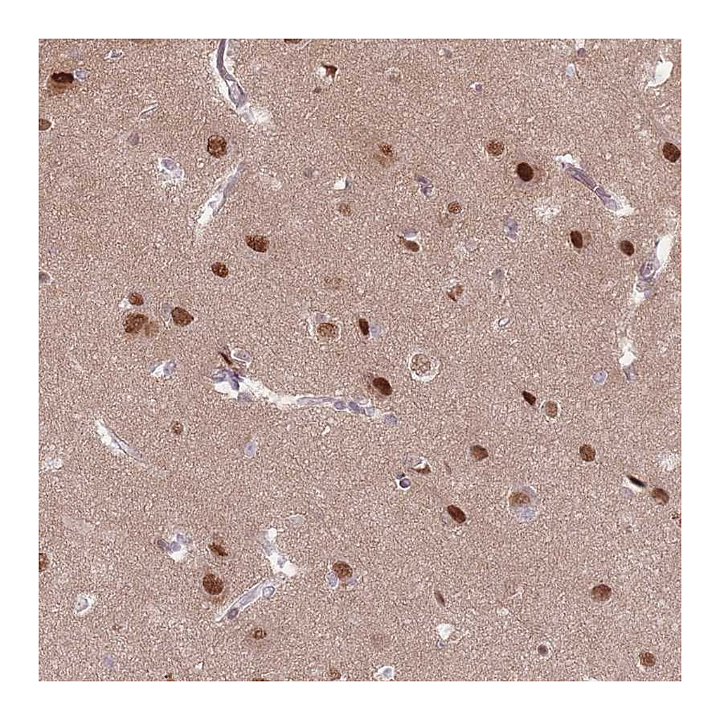 Atlas Antibodies Anti-SH3BGRL2 Antibody