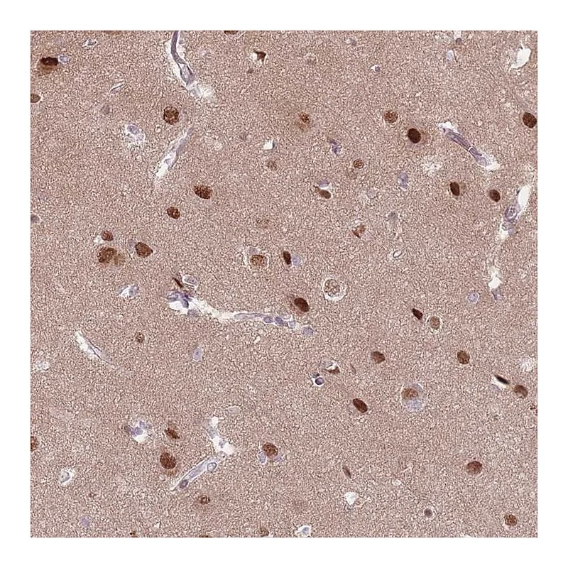Atlas Antibodies Anti-SH3BGRL2 Antibody
