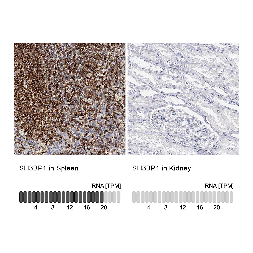 Atlas Antibodies Anti-SH3BP1 Antibody