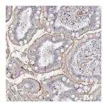 Atlas Antibodies Anti-SH3BP4 Antibody