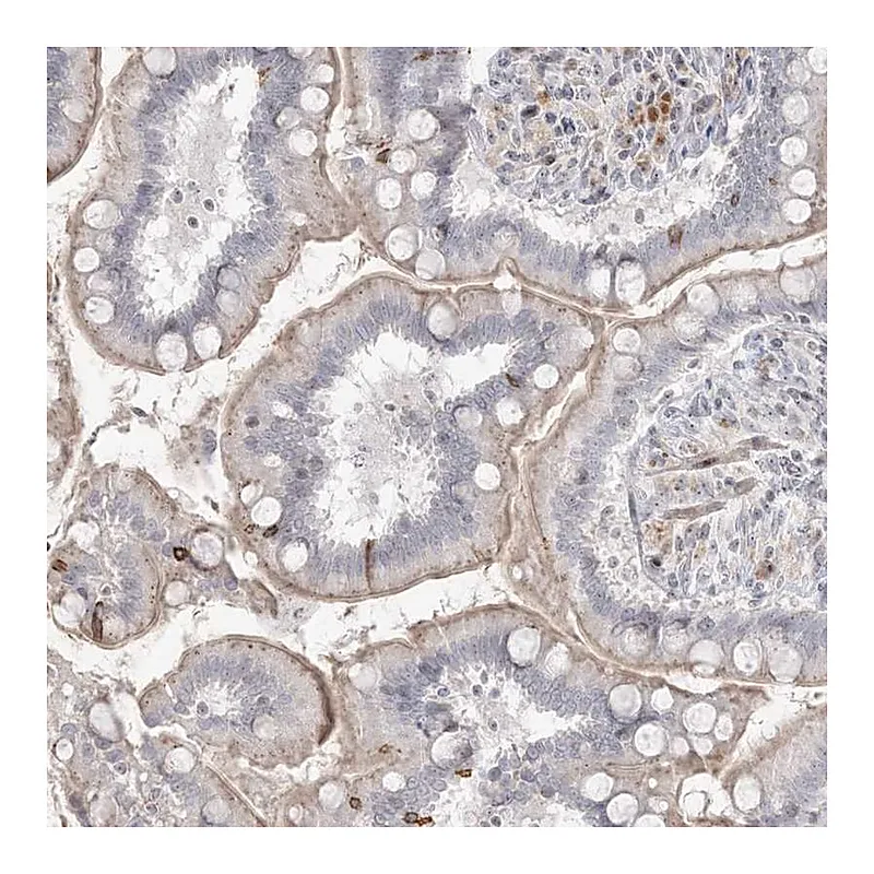 Atlas Antibodies Anti-SH3BP4 Antibody