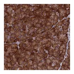 Atlas Antibodies Anti-SH3D21 Antibody