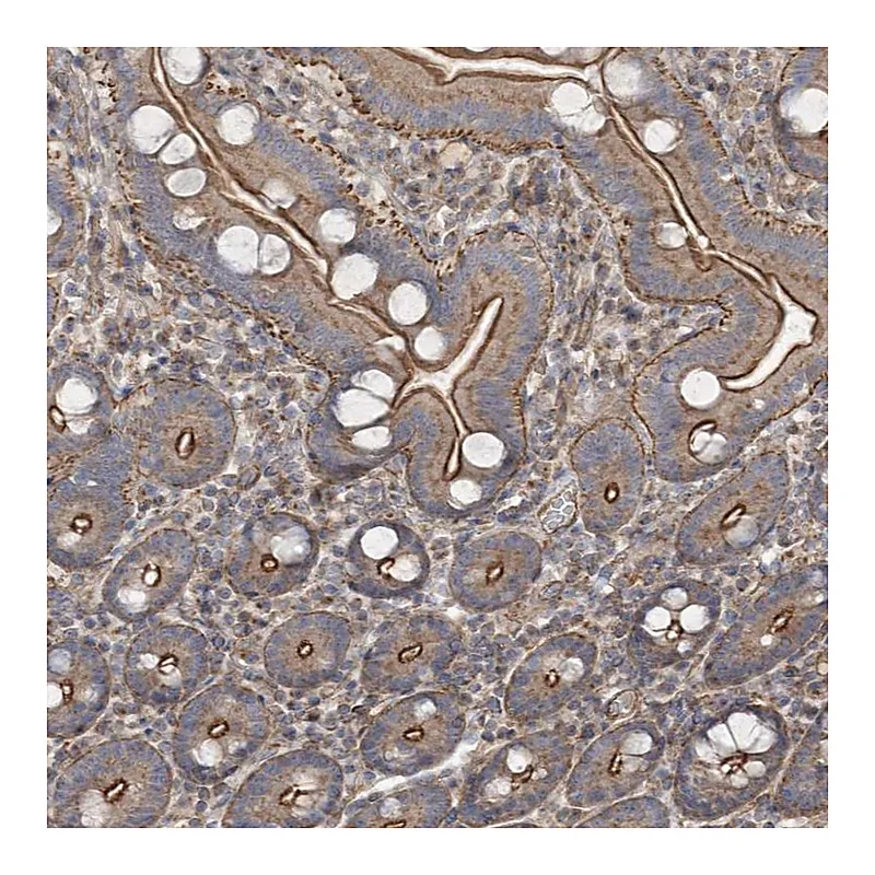Atlas Antibodies Anti-SH3BP5L Antibody