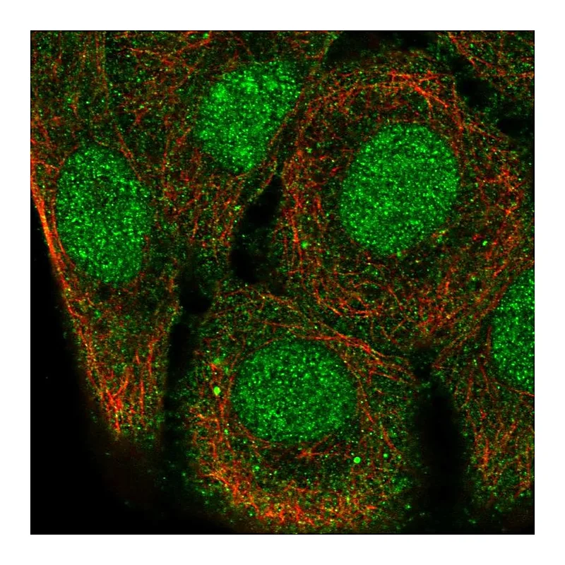 Atlas Antibodies Anti-SH3D21 Antibody