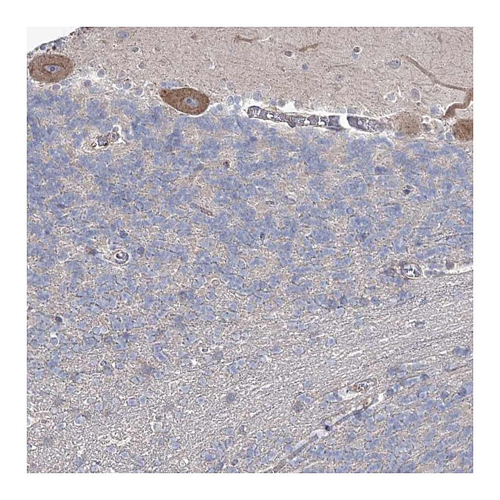 Atlas Antibodies Anti-SH3BP5L Antibody