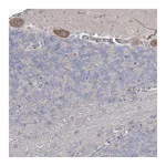 Atlas Antibodies Anti-SH3BP5L Antibody