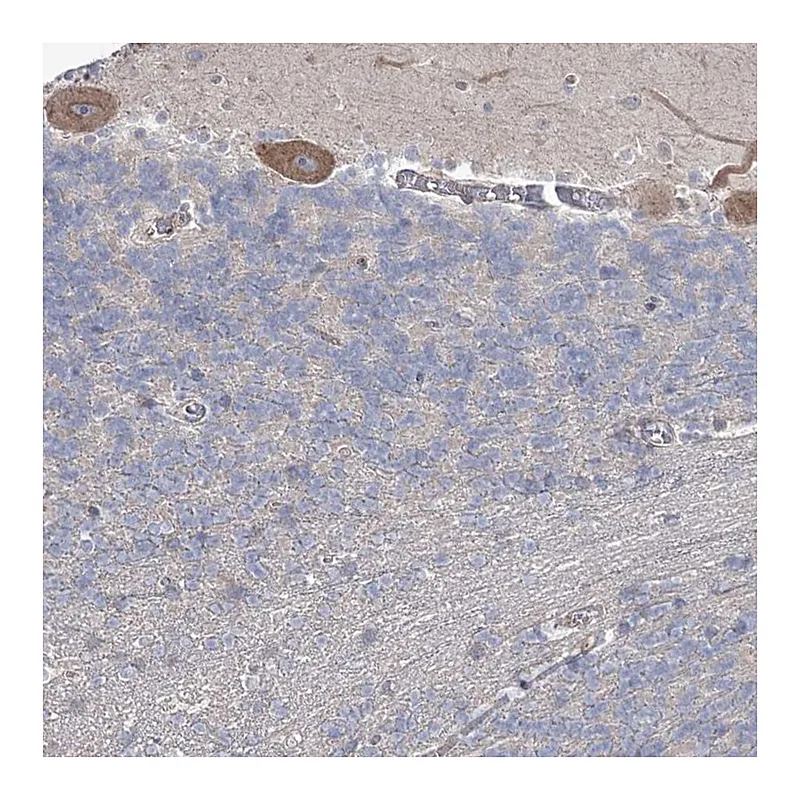 Atlas Antibodies Anti-SH3BP5L Antibody