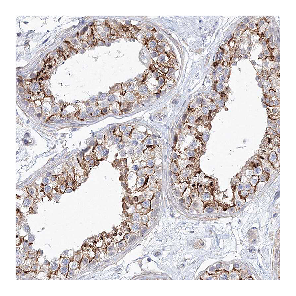 Atlas Antibodies Anti-SH3BP5 Antibody
