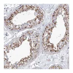 Atlas Antibodies Anti-SH3BP5 Antibody